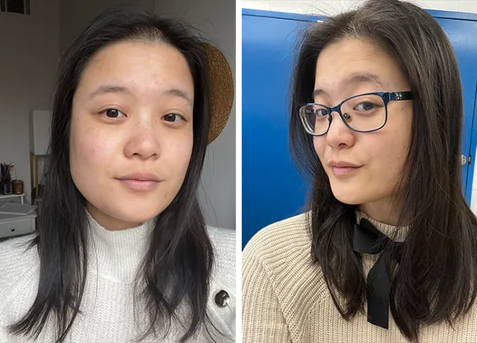 the ordinary hair serum review: before and after for purewow associate editor marissa wu' fetchpriority='auto' title='3 Editors Try The Ordinary Hair Serum. Here Are Their Honest Takes