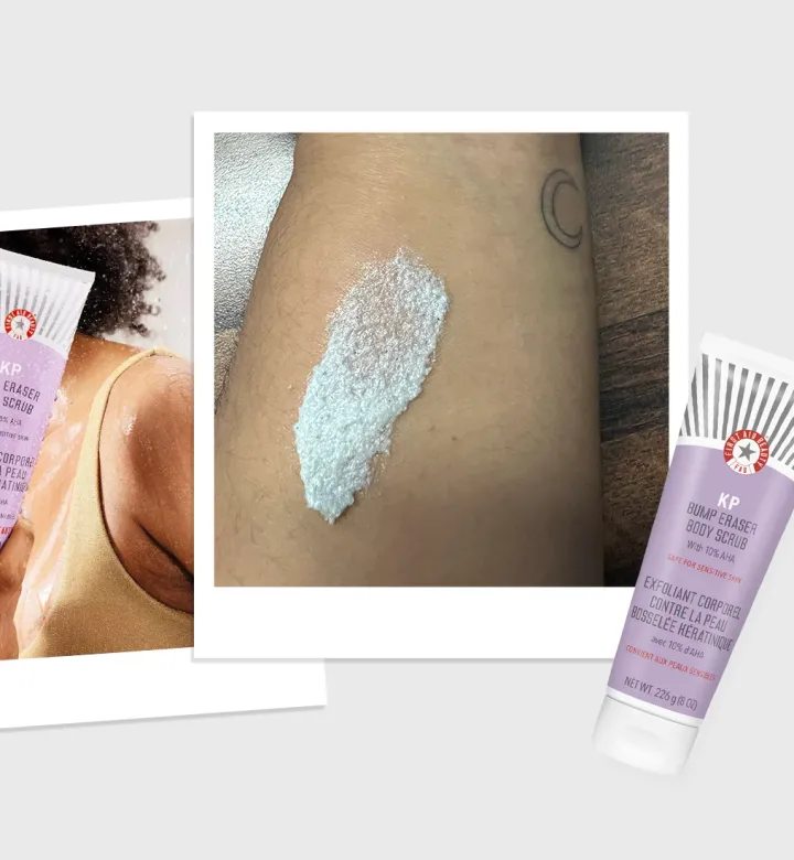 Ich habe das Erste -Hilfe -Beauty KP Bump Eraser -Scrub getestet, und es hat Wunder für meine Körperakne gemacht