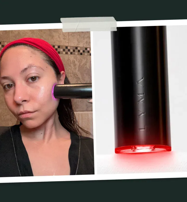 Yritin julkkis rakastettua Lyma-laseria 40 päivän ajan-onko se hypeen arvoinen?