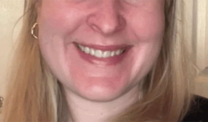 My Coffee Habit Stained My Teeth But This New Crest Toothpaste Whitened Them in Just 1 Day