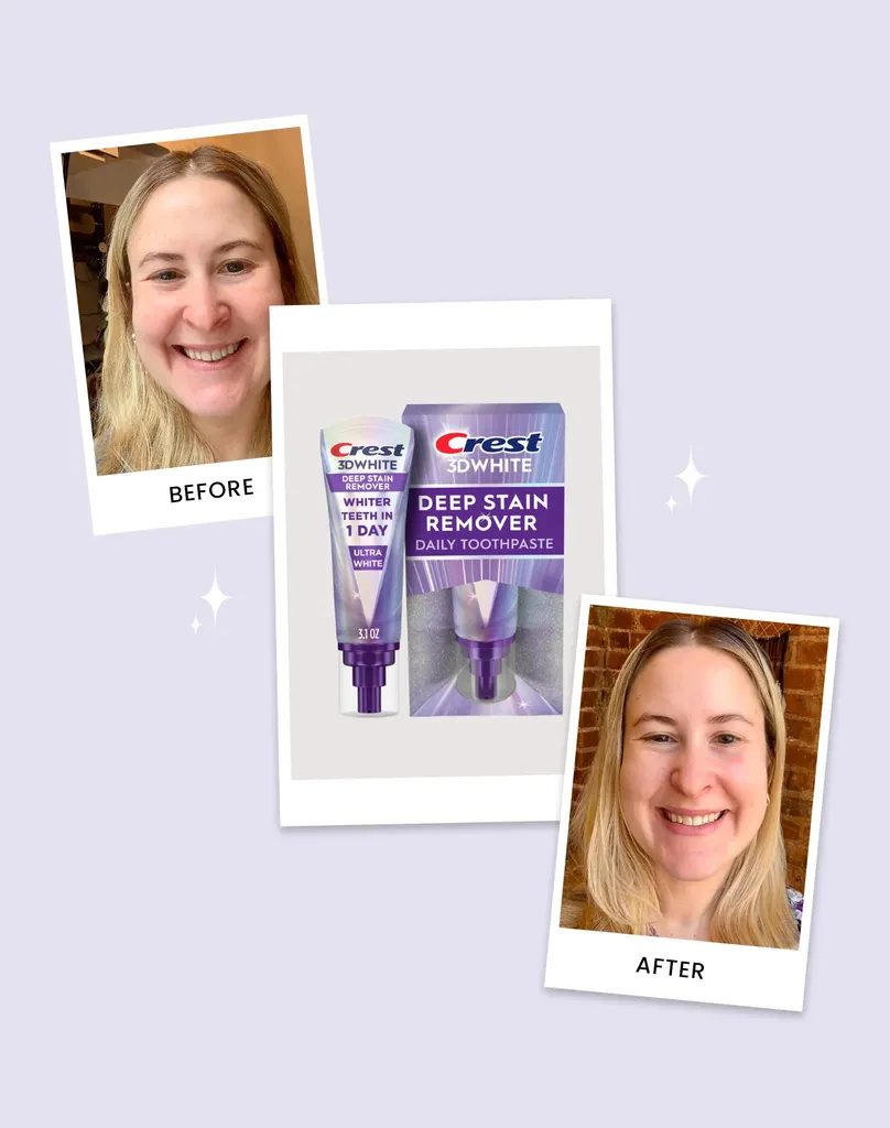 Kahvitapani värjäsi hampaani, mutta tämä uusi Crest -hammastahna valkaisi ne vain yhdessä päivässä
